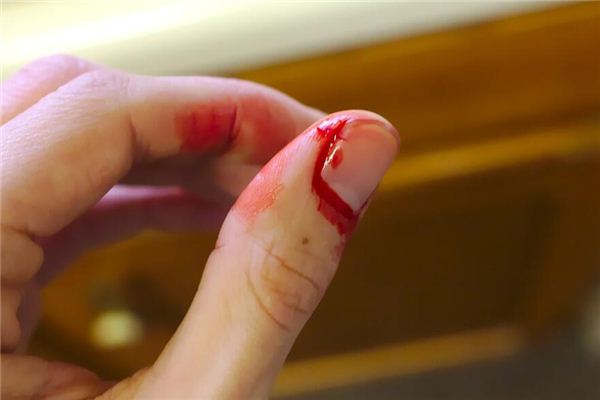 梦见手流血是什么意思 梦见手流血是什么意思